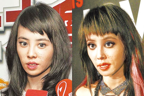 林志玲蔡依林揭秘明星尷尬的怪病